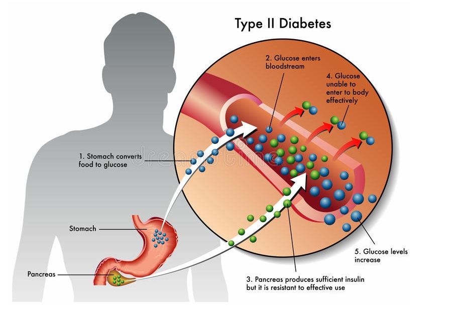 what is the presentation of diabetes mellitus