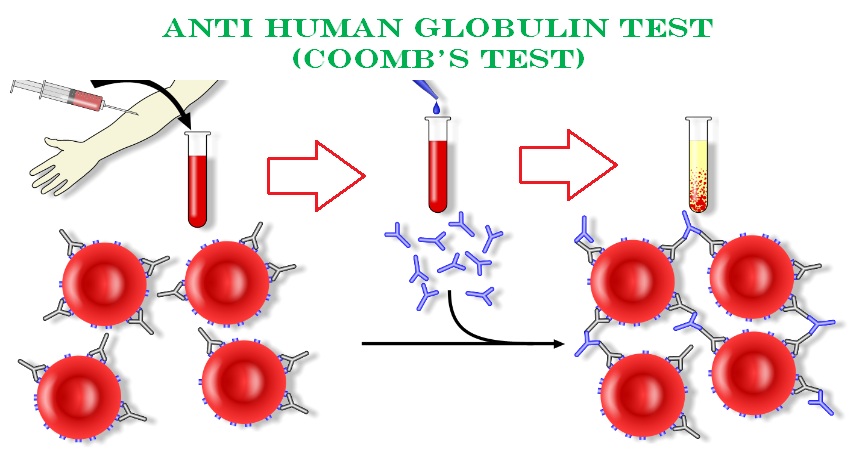 Anti Human Globulin Test (Coomb’s Test) 4.9 (2469)