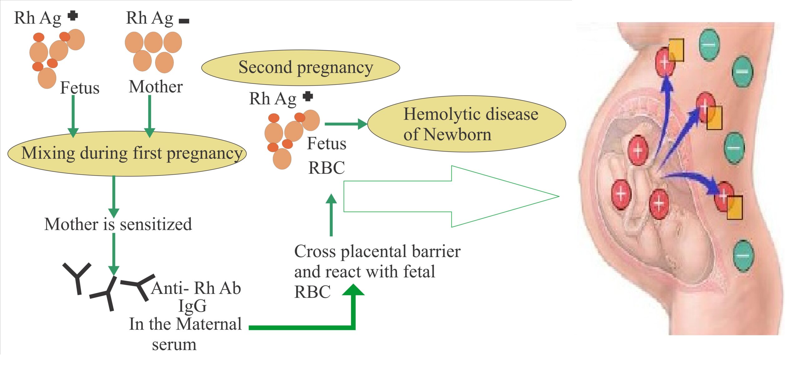 Blood Group and Pregnancy 5 (2879)