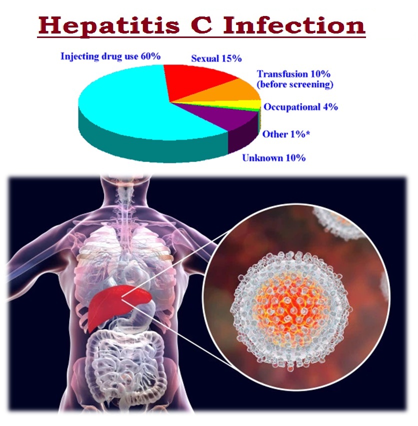Hepatitis C : Sign & Symptoms, Transmission, Risk factors, Diagnosis, Complication, Treatment and Prevention 4.6 (2561)
