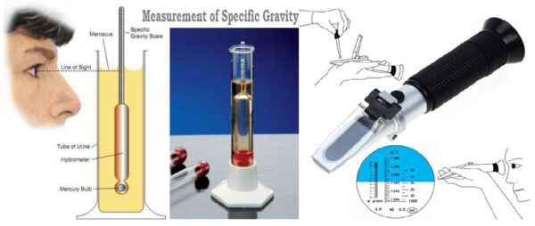 high specific gravity of urine