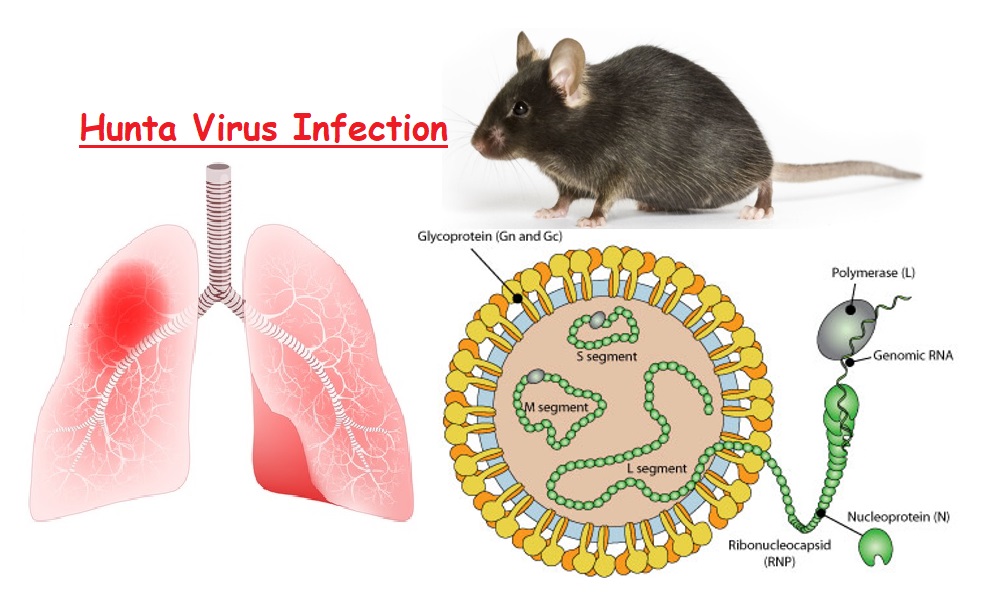 Hantavirus Infection 4.6 (2006)