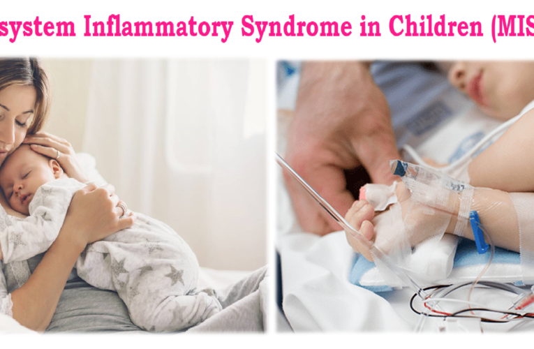 Multisystem Inflammatory Syndrome in Children (MIS-C) 4.9 (3553)
