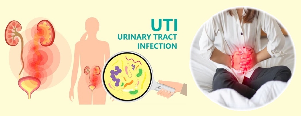 Urinary Tract Infection (UTIs) 4.9 (103)