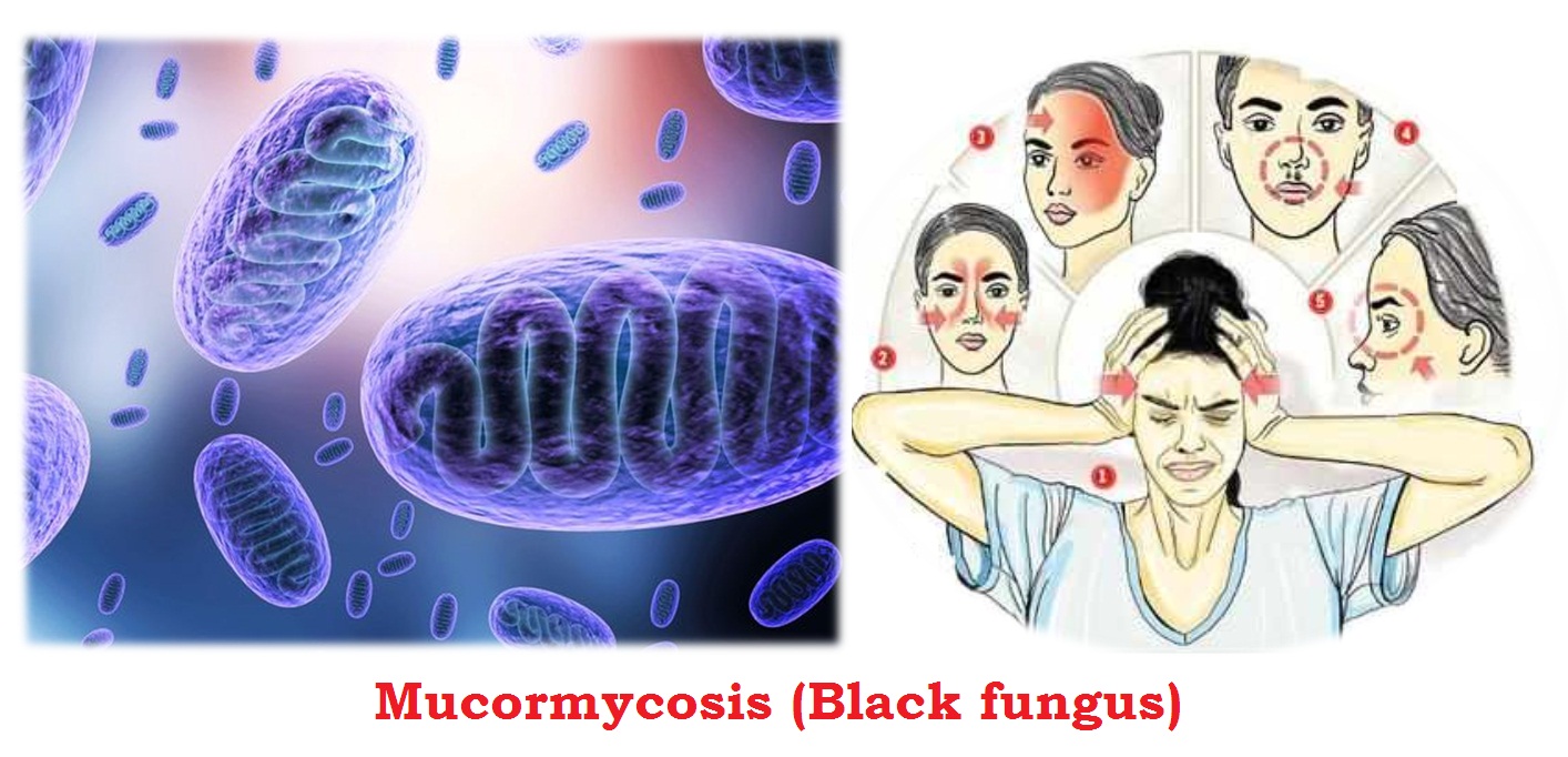 Mucormycosis or Black fungus : Sign & Symptoms, Precaution, Treatment and Prevention 5 (2162)