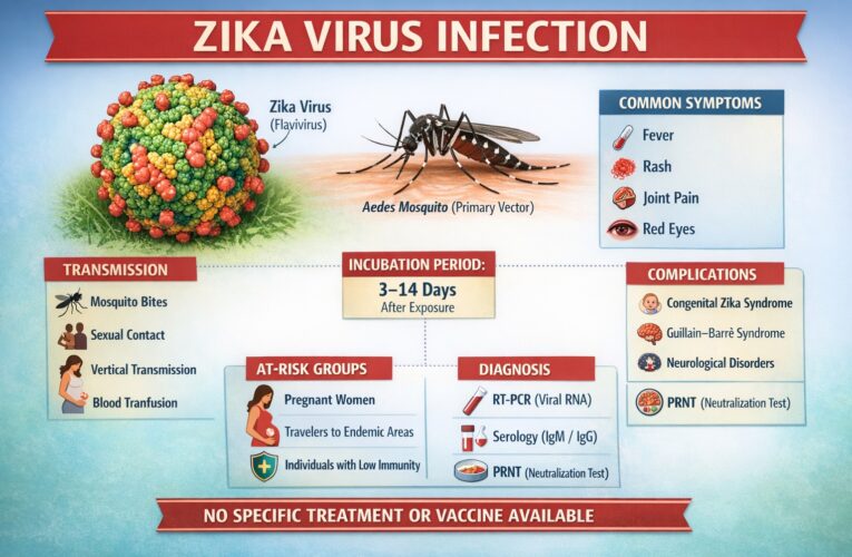 Zika virus Infection: Causes, Sign & Symptoms, Mode of Transmission, Diagnosis, Complication, Treatment and Prevention 4.9 (5865)