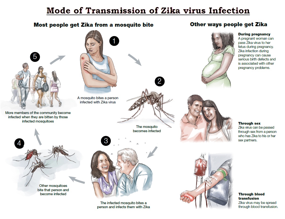 Zika Virus Infection Causes Sign And Symptoms Mode Of Transmission 