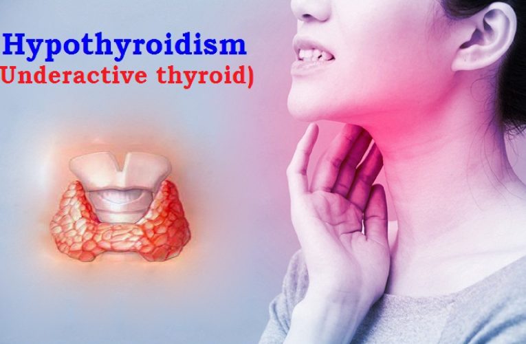 Hypothyroidism (Underactive thyroid) : Sign and Symptoms, Causes, Risk Factors, Mechanism, Diagnosis, Complications and Treatment 5 (3)