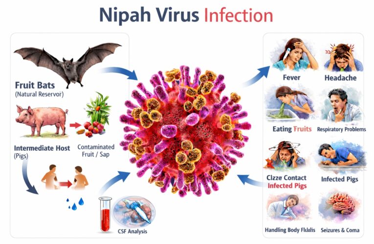 Nipah Virus Infection – Sign and Symptoms, Risk factors, Diagnosis, Complications, Treatment and Prevention 4.9 (15692)