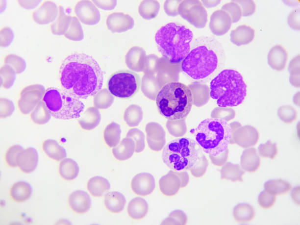 Haematology